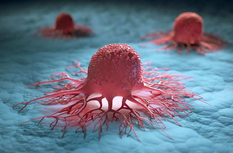 Hình ảnh cho tế bào bệnh ung thư